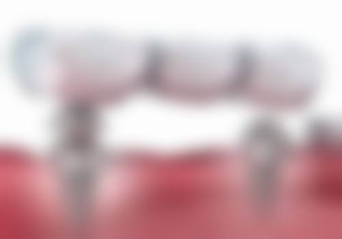 宁波德中口腔门诊部预约挂号方式