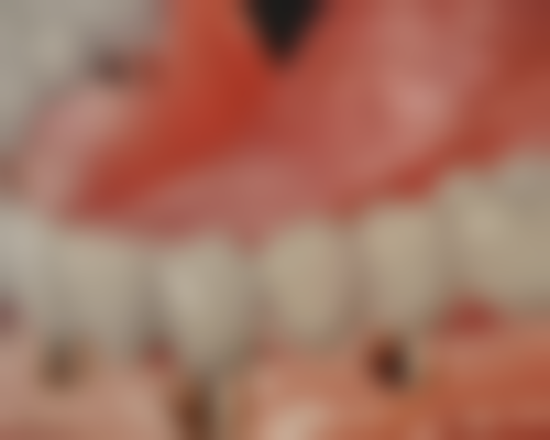 日照东港博恩口腔门诊部收费价格表