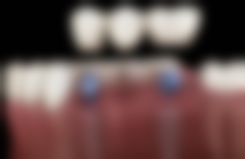 山东德州禹城富星口腔特色诊疗项目与技术优势