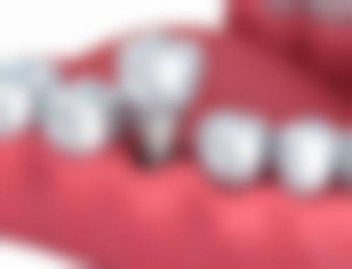 巴中白玉牙科(江北店)预约挂号方式