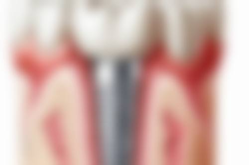 烟台伊良玖雅美口腔门诊部收费价格表