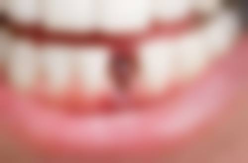 建水县雅美口腔诊所地址电话、营业时间