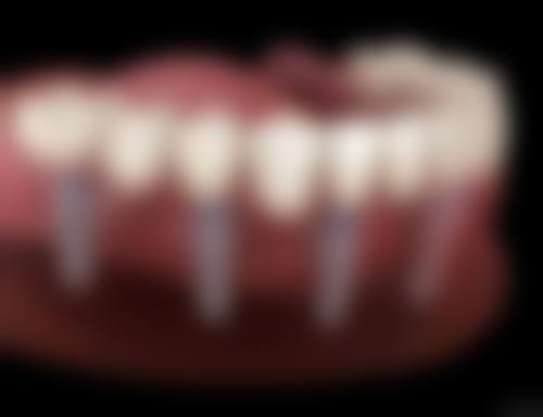 枝江乐一口腔门诊部收费价格表