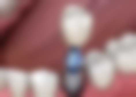 温州瑞安潘孝春口腔医生团队介绍