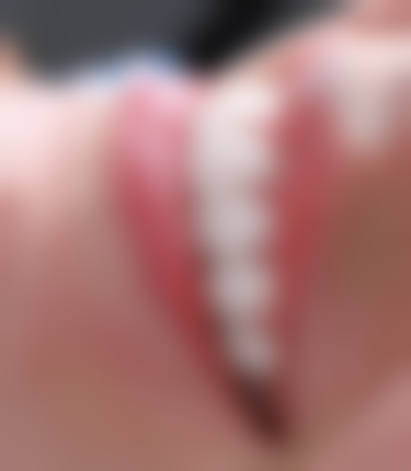 江苏镇江顾洪口腔诊所预约挂号方式