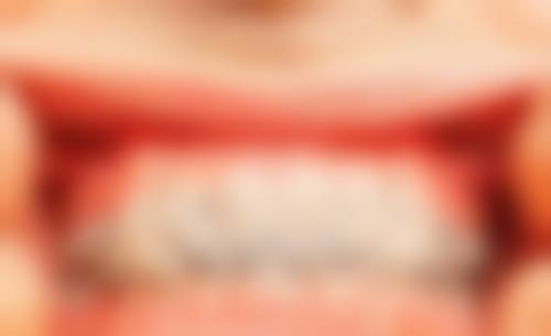 雷琪蓝医生项目收费价格