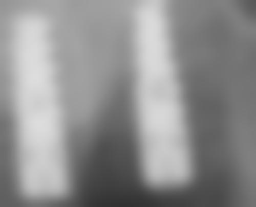 湖南郴州临武升星口腔预约挂号方式