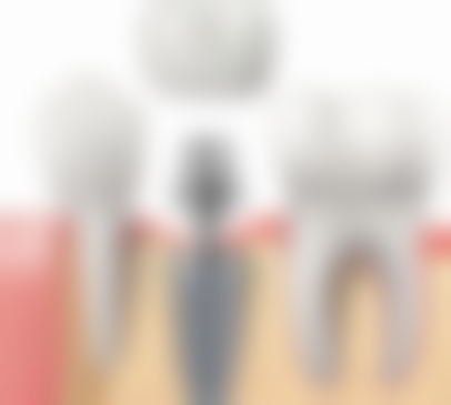 莆田群益口腔门诊部收费价格表