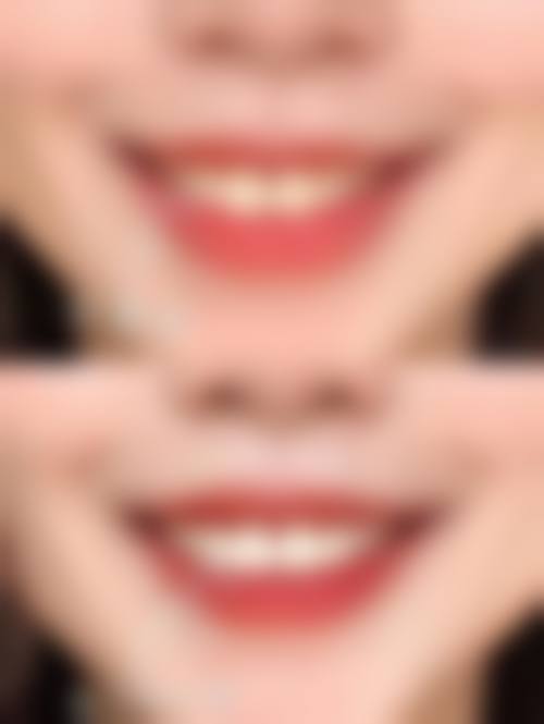 咸阳市杨凌区瑞超口腔王超医生项目收费价格