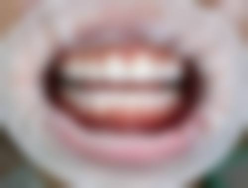 山东泰安焕新口腔收费价格表