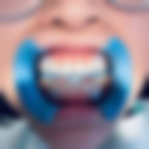 广东深圳贝尔美口腔诊所预约挂号方式