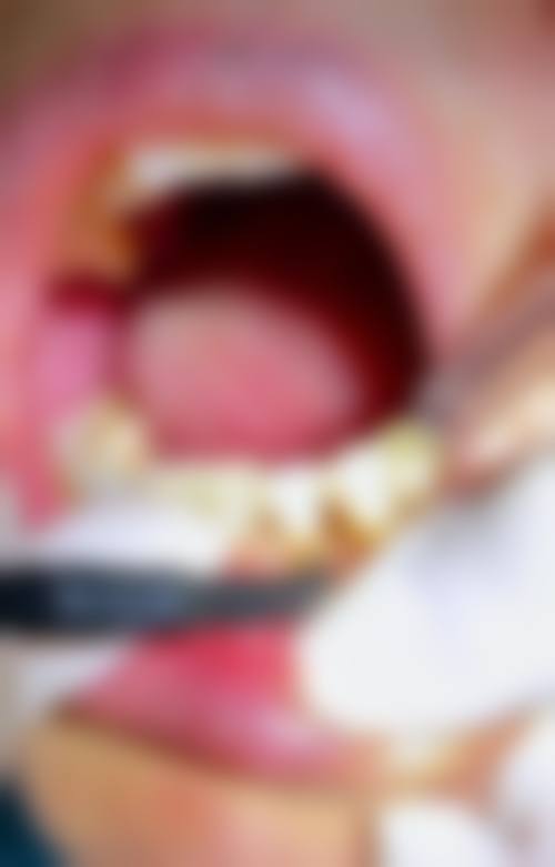 温州龙港谢晋鹏口腔特色诊疗项目与技术优势