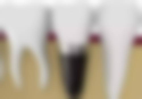 谢朝阳医生项目收费价格