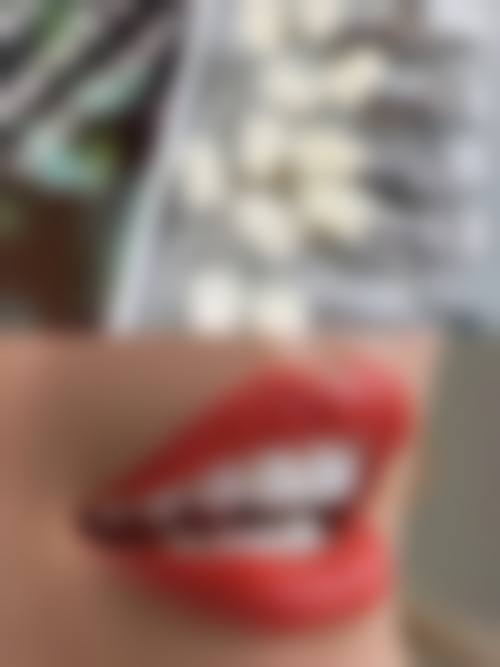 陈祖新医生项目收费价格