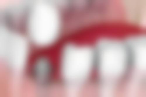 湖北黄冈雅美口腔特色诊疗项目与技术优势