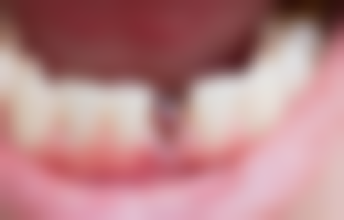 郑亚芸医生预约挂号