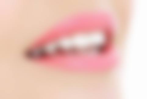 东莞牙世家口腔收费价格表