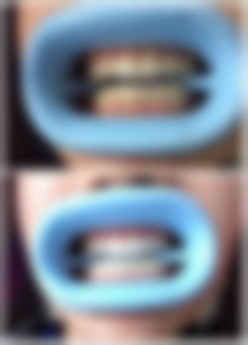 杭州民生多仁口腔（西溪门诊部）收费价格