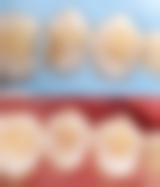 南宁柏乐口腔（江南万达店）收费价格表