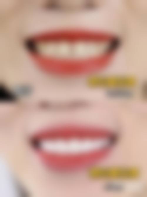 陈祖新医生技术优势