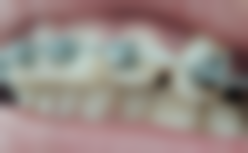 刘巧萍医生项目收费价格