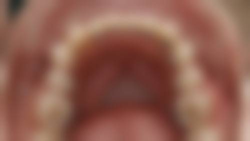 兰州牙王国数字化口腔门诊部收费价格表