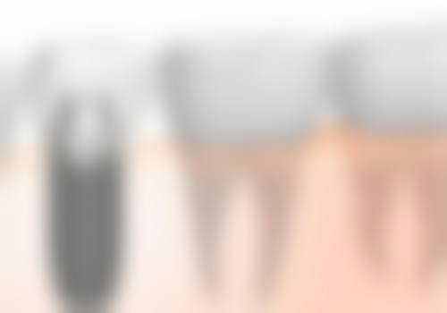 重庆九龙坡侯恩杰口腔预约挂号方式