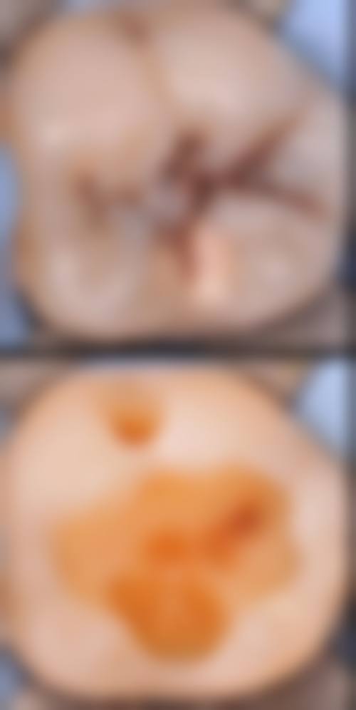 济南莱芜众惠口腔预约挂号方式