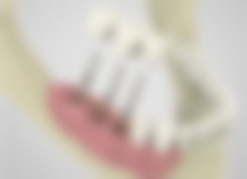 广东东莞东城百花口腔门诊部特色诊疗项目与技术优势