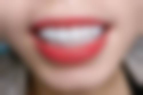 臻吻口腔门诊部特色诊疗项目与技术优势