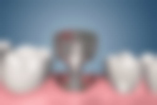 诸城宇宸口腔预约挂号方式