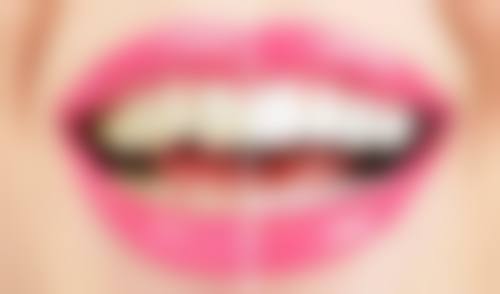 广东东莞全家福口腔收费价格表