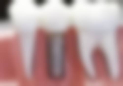 云南大理来诗美口腔医生团队介绍