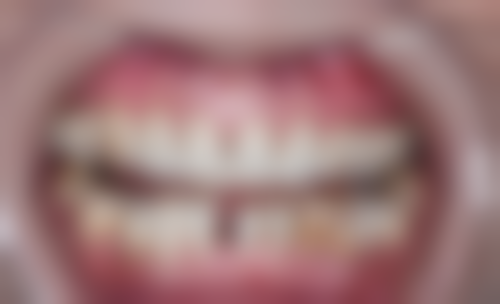 黑龙江悦牙口腔门诊部地址电话、营业时间