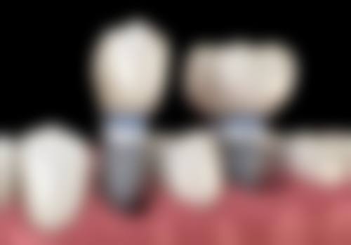 驻马店市啄木鸟口腔(文化路店)预约挂号方式