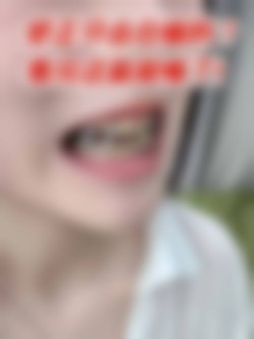 金华贝齿乐口腔门诊部收费价格表