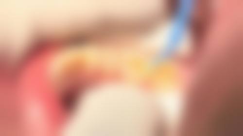 湖北荆州詹威口腔预约挂号方式