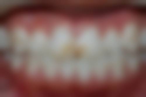 常州市武进人民医院周尧医生口碑评价及反馈内容