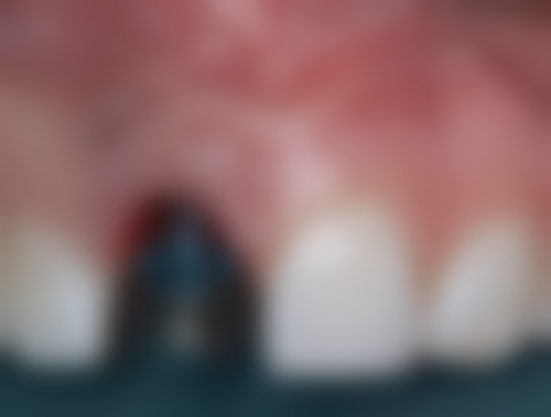 浙江台州路桥雅汇口腔收费价格表