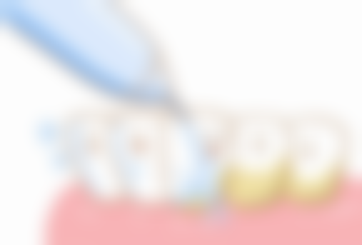 黄斯敏医生项目收费价格