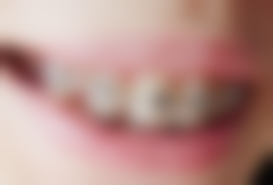 安徽淮北张大庆口腔特色诊疗项目与技术优势