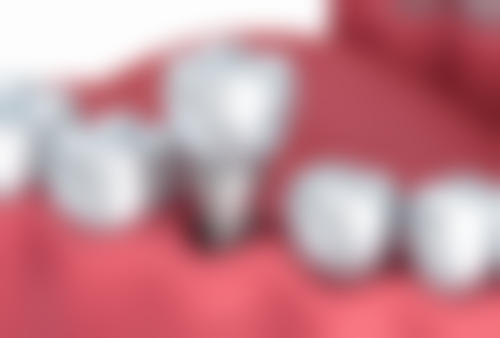 徐超凡医生技术优势