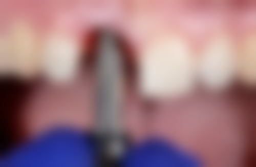 李珂医生技术优势