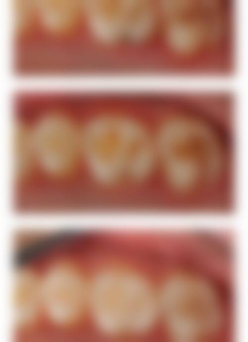 济南历城齿客口腔收费价格表