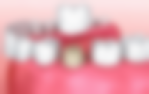 黄玉坤医生技术优势