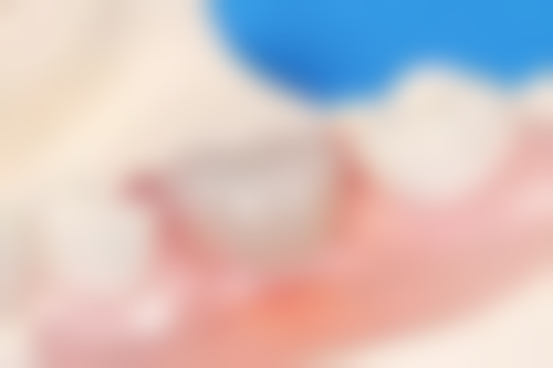 广东汕头大象口腔诊所地址电话、营业时间