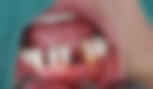 郑亚芸医生项目收费价格