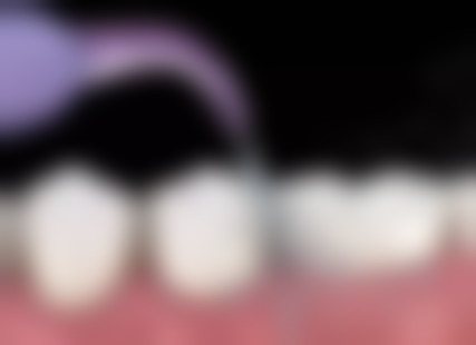 郭战月医生项目收费价格