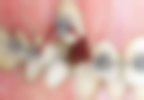 大连奥美口腔门诊部收费价格表