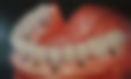 内蒙古赤峰市红山区爱笑口腔收费价格表